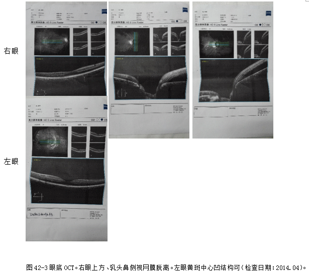 ZY016_234_2.gif